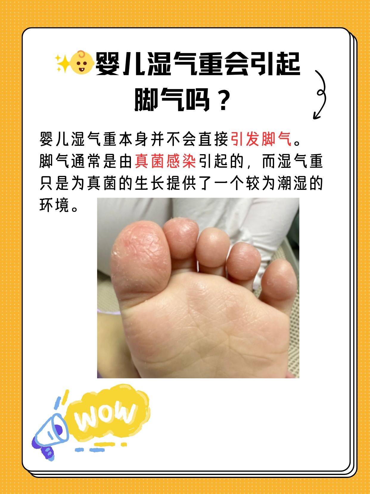 宝宝体内湿气与脚气：家长需知的真相与调理方法