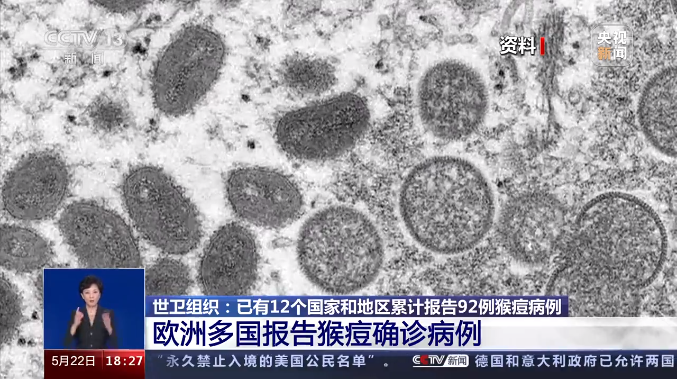 猴痘又称为“猴天花”,已发生人际传播,对人类的危害有多大?